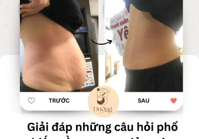 Giải đáp tất tần tật những câu hỏi phổ biến về massage giảm cân